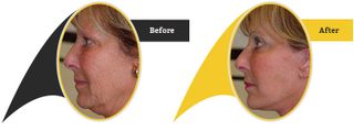 Illustration for article titled Face Lift in Islamabad